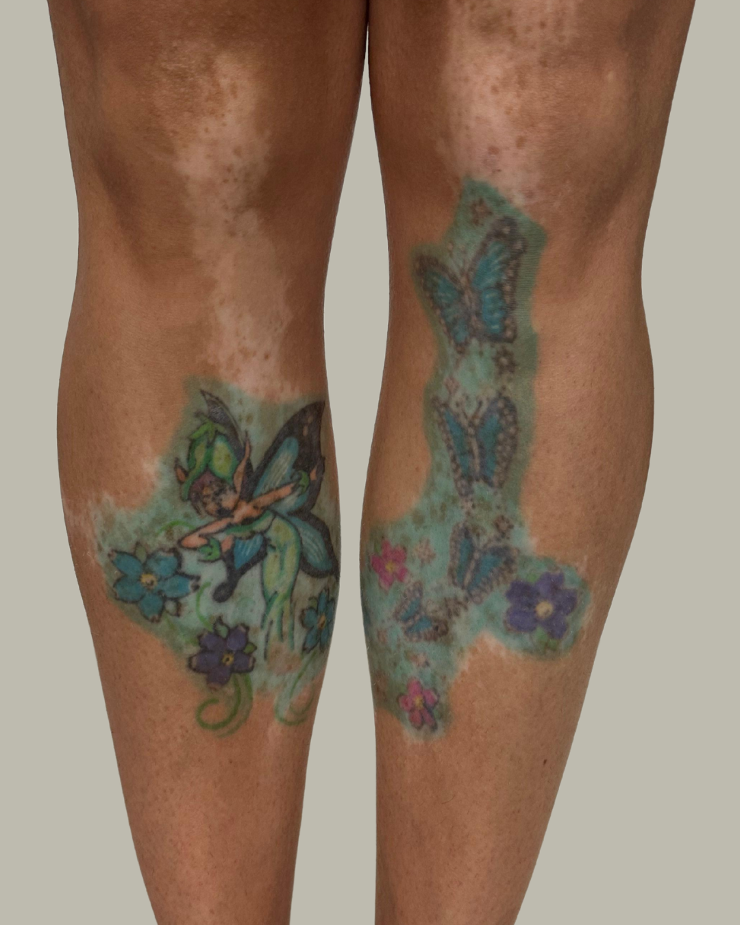 cobertura de tatuagem, cobertura de tatuagem masculina e feminina, cobrir tatuagem no braço, tatuagens cobrir cicatrizes, tatuagem cobertura, reformas de tattoo, Samara christo tattoo - 36